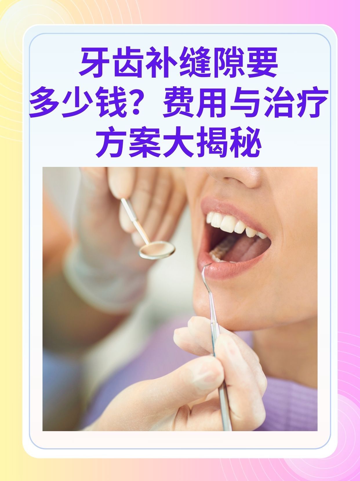 张家界补牙医保可以报销吗(补牙医保可以报销吗 哪些可以报销呢)